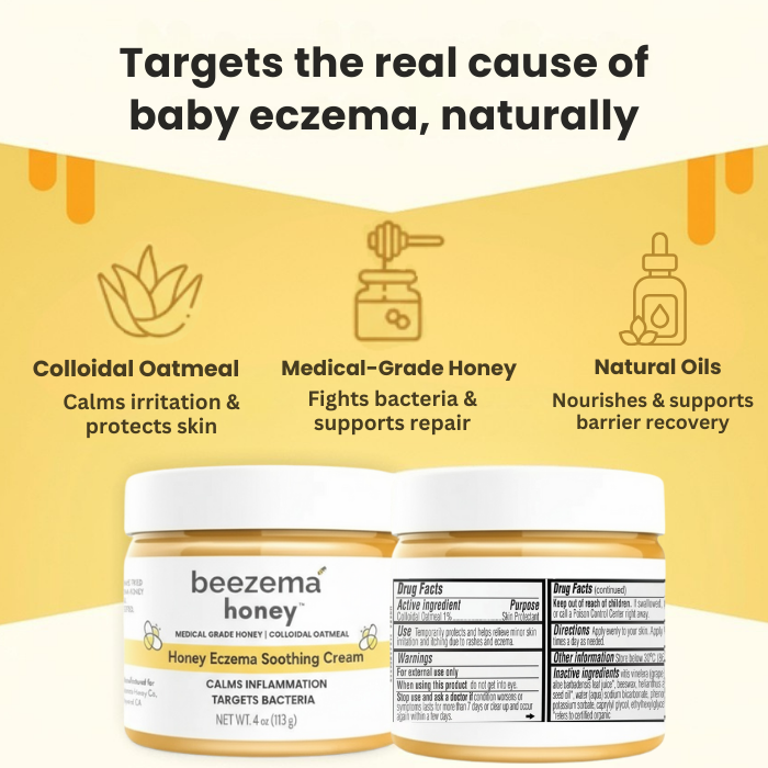 babee eczema cream