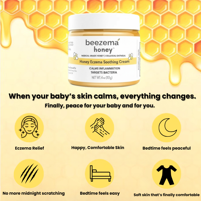 babee eczema cream