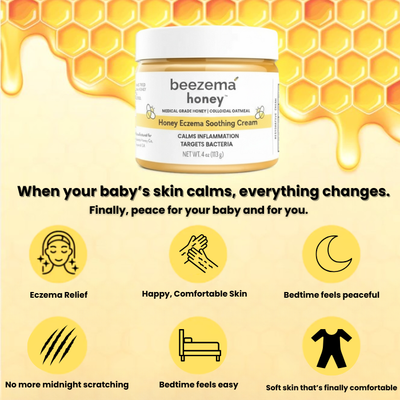 babee eczema cream